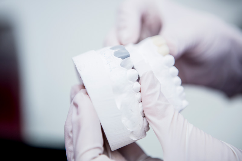 Zahnarztpraxis A. Exner am Geiseltalsee – Ästhetischer Zahnersatz